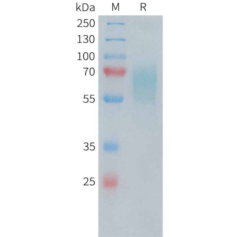 SDS-PAGE - Recombinant Human CD30 Protein (6×His Tag) (A318247) - Antibodies.com