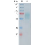 SDS-PAGE - Recombinant Human CD30 Protein (6×His Tag) (A318247) - Antibodies.com