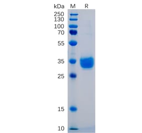 SDS-PAGE - Recombinant Human PD-L1 Protein (6×His Tag) (A318248) - Antibodies.com