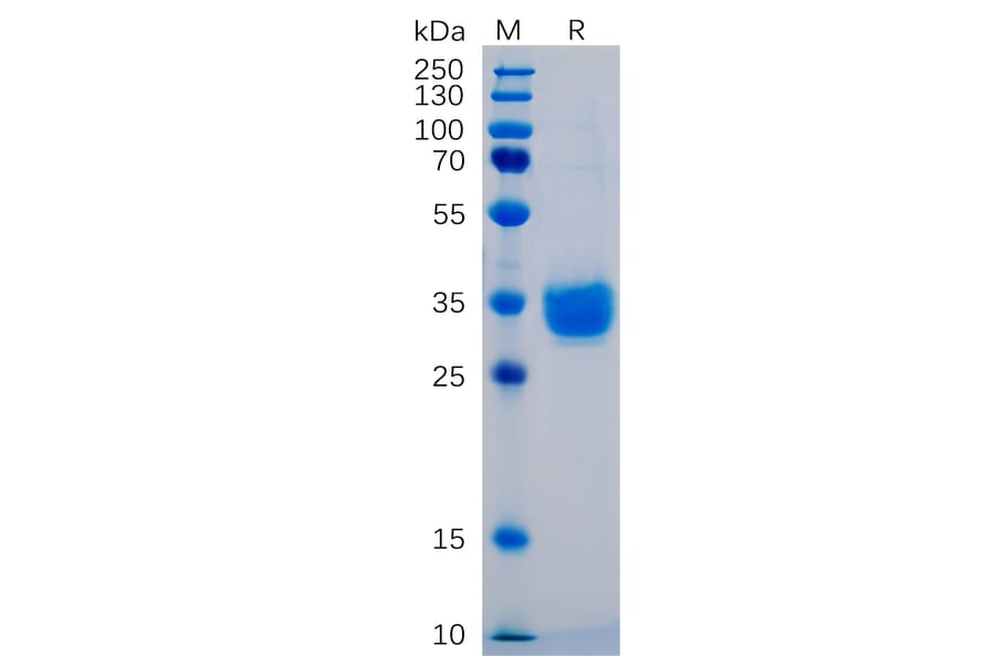 SDS-PAGE - Recombinant Human PD-L1 Protein (6×His Tag) (A318248) - Antibodies.com