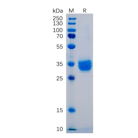 SDS-PAGE - Recombinant Human PD-L1 Protein (6×His Tag) (A318248) - Antibodies.com