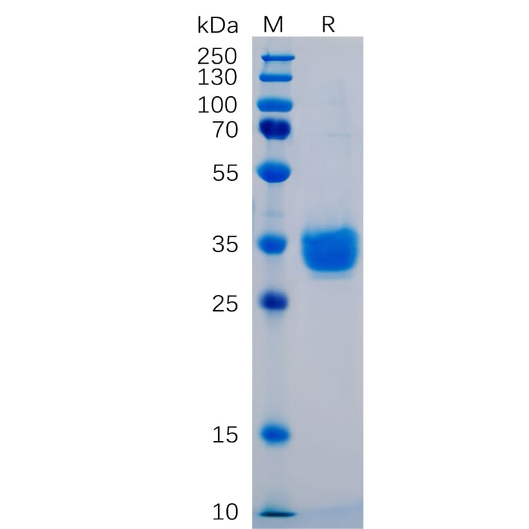 SDS-PAGE - Recombinant Human PD-L1 Protein (6×His Tag) (A318248) - Antibodies.com
