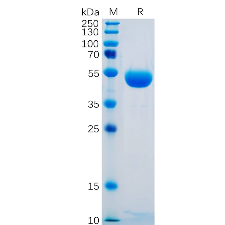 SDS-PAGE - Recombinant Human CTLA4 Protein (Fc Tag) (A318249) - Antibodies.com