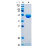 SDS-PAGE - Recombinant Human CTLA4 Protein (Fc Tag) (A318249) - Antibodies.com