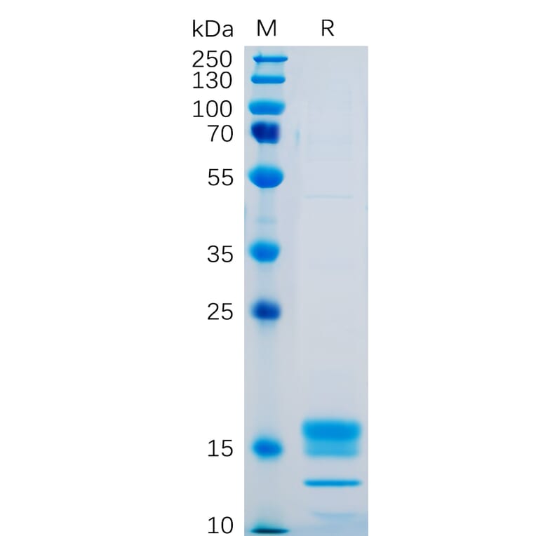 SDS-PAGE - Recombinant Human TNFSF18/GITRL Protein (6×His Tag) (A318250) - Antibodies.com