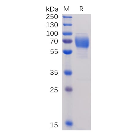 SDS-PAGE - Recombinant Human 2B4 Protein (Fc Tag) (A318251) - Antibodies.com