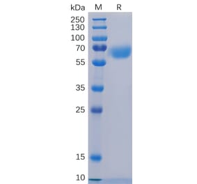 SDS-PAGE - Recombinant Human CD48 Protein (Fc Tag) (A318252) - Antibodies.com