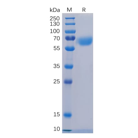 SDS-PAGE - Recombinant Human CD48 Protein (Fc Tag) (A318252) - Antibodies.com
