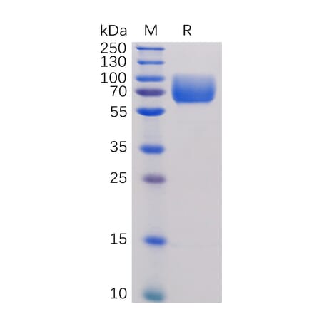 SDS-PAGE - Recombinant Human CD86 Protein (Fc Tag) (A318254) - Antibodies.com