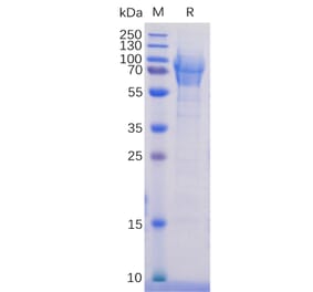 SDS-PAGE - Recombinant Human PSGL-1 Protein (6×His Tag) (A318256) - Antibodies.com