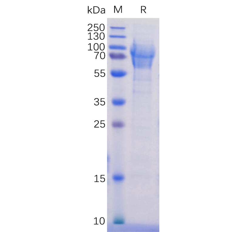 SDS-PAGE - Recombinant Human PSGL-1 Protein (6×His Tag) (A318256) - Antibodies.com