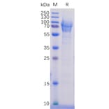 SDS-PAGE - Recombinant Human PSGL-1 Protein (6×His Tag) (A318256) - Antibodies.com