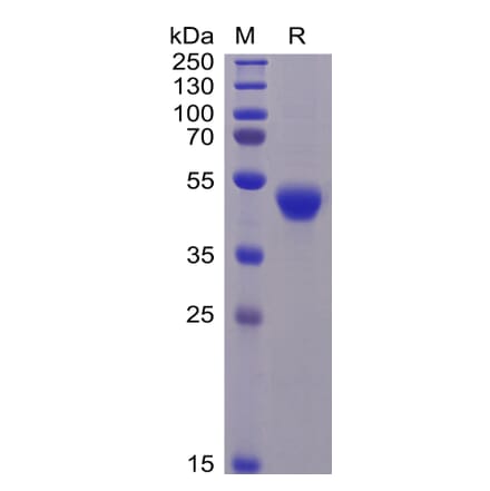 SDS-PAGE - Recombinant Human CD5 Protein (6×His Tag) (A318257) - Antibodies.com