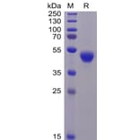 SDS-PAGE - Recombinant Human CD5 Protein (6×His Tag) (A318257) - Antibodies.com