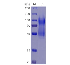 SDS-PAGE - Recombinant Human CD34 Protein (6×His Tag) (A318258) - Antibodies.com