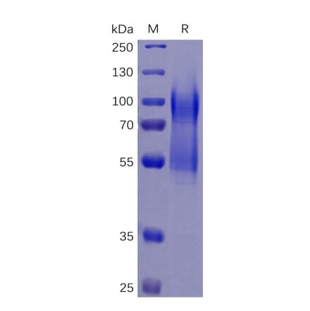 SDS-PAGE - Recombinant Human CD34 Protein (6×His Tag) (A318258) - Antibodies.com