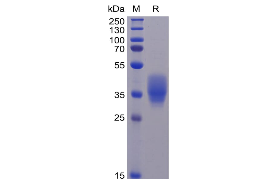 SDS-PAGE - Recombinant Human CD200/OX2 Protein (6×His Tag) (A318260) - Antibodies.com