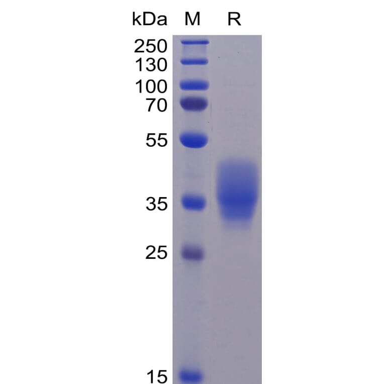 SDS-PAGE - Recombinant Human CD200/OX2 Protein (6×His Tag) (A318260) - Antibodies.com