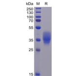 SDS-PAGE - Recombinant Human CD200/OX2 Protein (6×His Tag) (A318260) - Antibodies.com