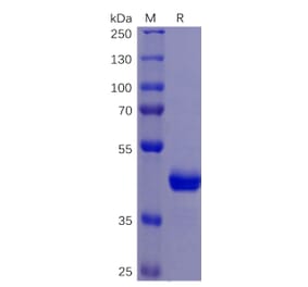 SDS-PAGE - Recombinant Human DR5 Protein (Fc Tag) (A318261) - Antibodies.com