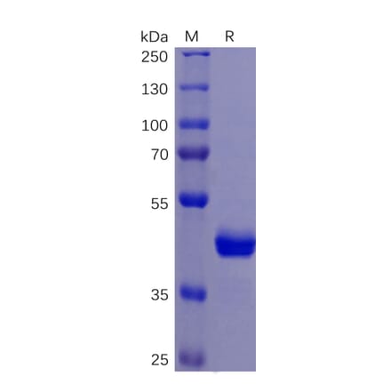 SDS-PAGE - Recombinant Human DR5 Protein (Fc Tag) (A318261) - Antibodies.com