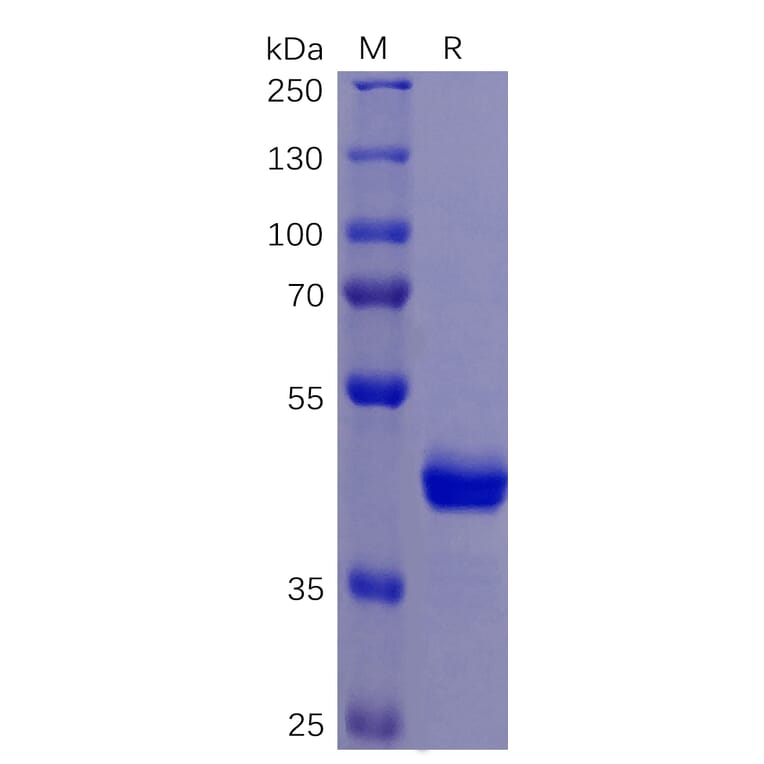 SDS-PAGE - Recombinant Human DR5 Protein (Fc Tag) (A318261) - Antibodies.com