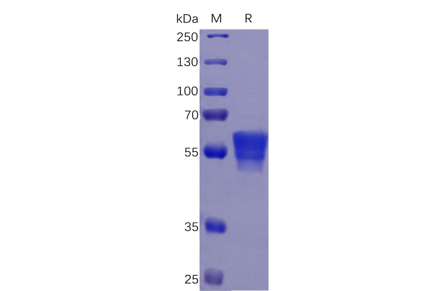 SDS-PAGE - Recombinant Human CD7 Protein (Fc Tag) (A318262) - Antibodies.com