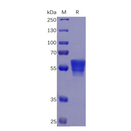 SDS-PAGE - Recombinant Human CD7 Protein (Fc Tag) (A318262) - Antibodies.com