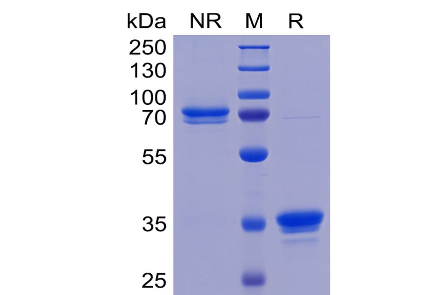 SDS-PAGE - Recombinant Human TWEAKR/FN14 Protein (Fc Tag) (A318263) - Antibodies.com