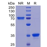 SDS-PAGE - Recombinant Human TWEAKR/FN14 Protein (Fc Tag) (A318263) - Antibodies.com