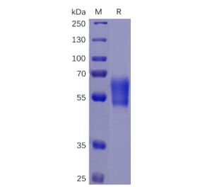 SDS-PAGE - Recombinant Human PD1 Protein (Fc Chimera 6xHis Tag) (A318264) - Antibodies.com