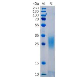 SDS-PAGE - Recombinant Human PD1 Protein (6×His Tag) (A318265) - Antibodies.com