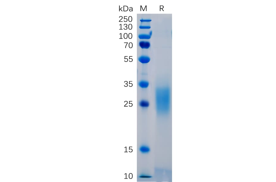 SDS-PAGE - Recombinant Human PD1 Protein (6×His Tag) (A318265) - Antibodies.com