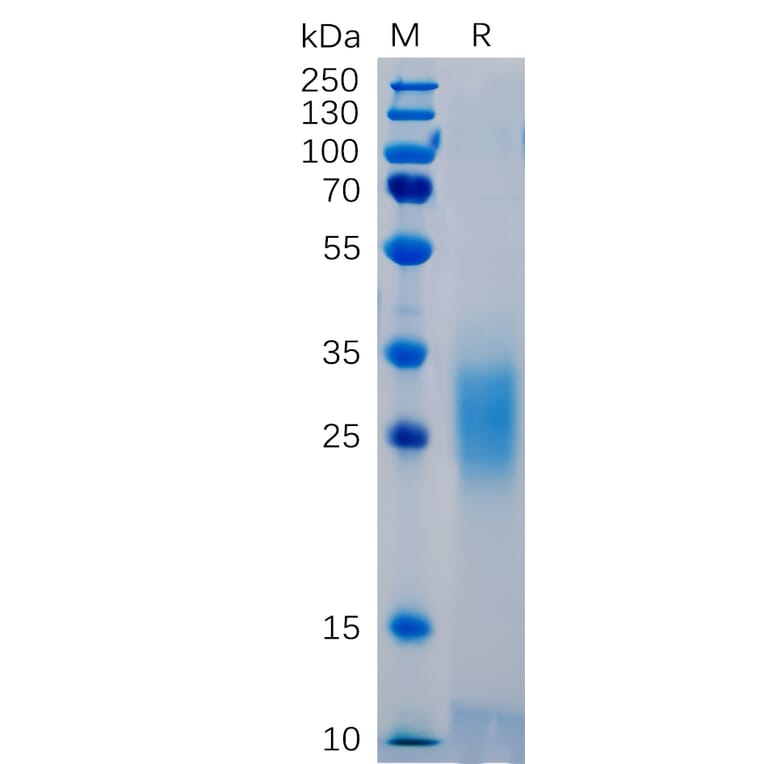 SDS-PAGE - Recombinant Human PD1 Protein (6×His Tag) (A318265) - Antibodies.com