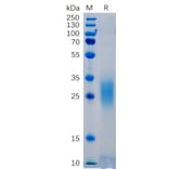 SDS-PAGE - Recombinant Human PD1 Protein (6×His Tag) (A318265) - Antibodies.com