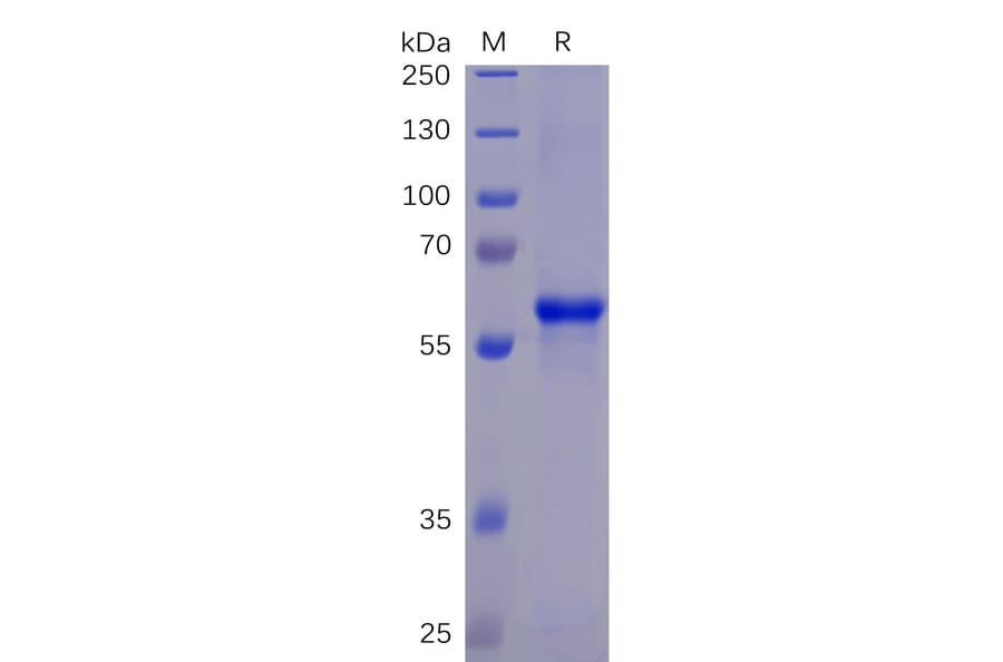 SDS-PAGE - Recombinant SARS-CoV-2 Spike Glycoprotein RBD Protein (Fc Chimera 6xHis Tag) (A318266) - Antibodies.com