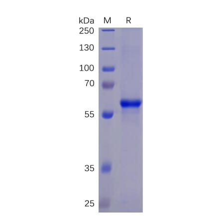 SDS-PAGE - Recombinant SARS-CoV-2 Spike Glycoprotein RBD Protein (Fc Chimera 6xHis Tag) (A318266) - Antibodies.com