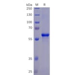 SDS-PAGE - Recombinant SARS-CoV-2 Spike Glycoprotein RBD Protein (Fc Chimera 6xHis Tag) (A318266) - Antibodies.com