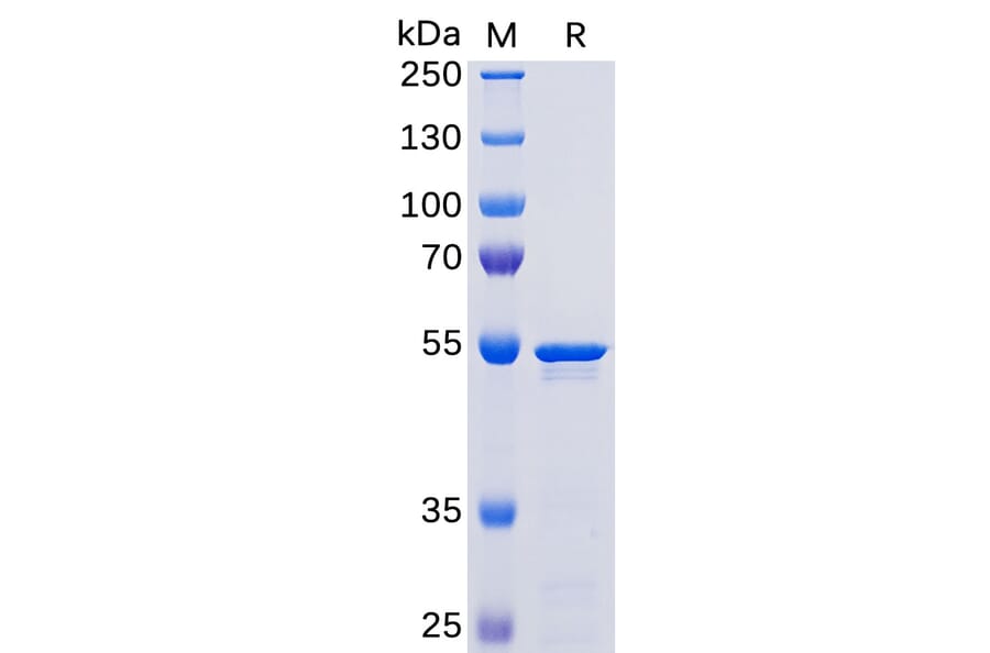 SDS-PAGE - Recombinant SARS-CoV-2 Nucleocapsid Protein (His Tag) (A318267) - Antibodies.com