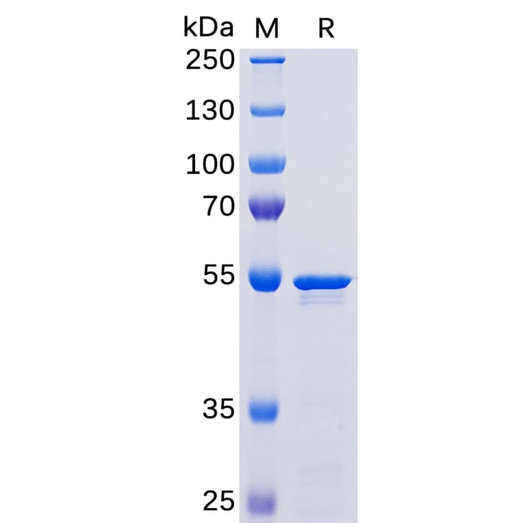 SDS-PAGE - Recombinant SARS-CoV-2 Nucleocapsid Protein (His Tag) (A318267) - Antibodies.com