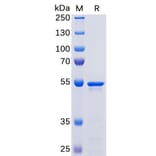 SDS-PAGE - Recombinant SARS-CoV-2 Nucleocapsid Protein (His Tag) (A318267) - Antibodies.com