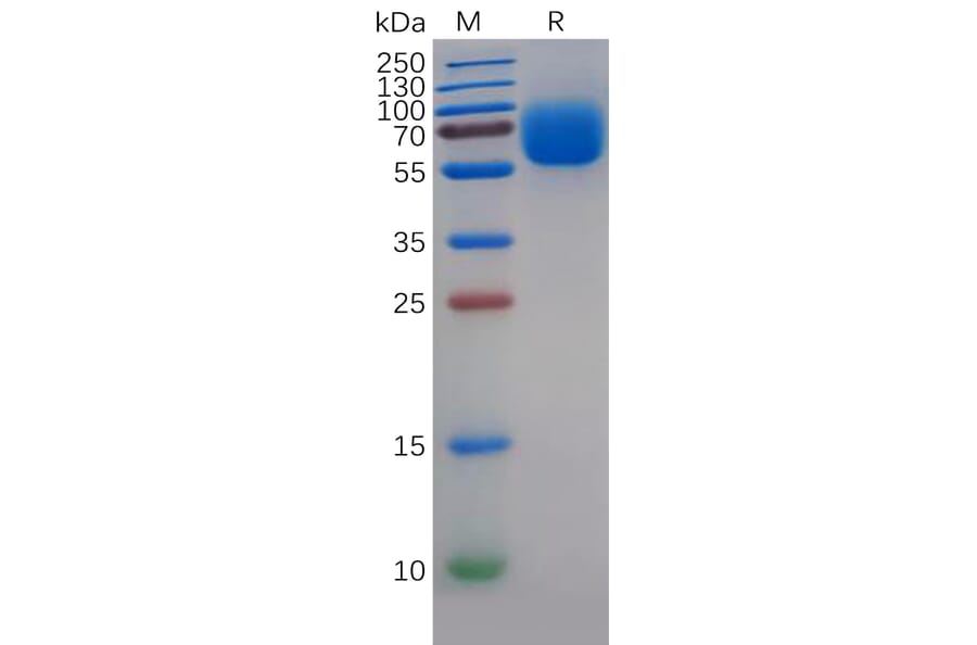 SDS-PAGE - Recombinant Human TYRO3 Protein (6×His Tag) (A318268) - Antibodies.com