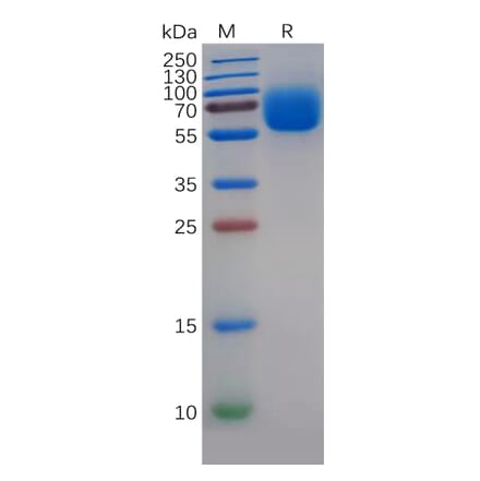 SDS-PAGE - Recombinant Human TYRO3 Protein (6×His Tag) (A318268) - Antibodies.com