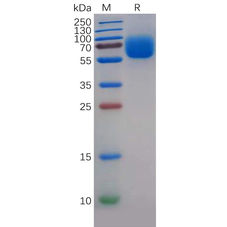 SDS-PAGE - Recombinant Human TYRO3 Protein (6×His Tag) (A318268) - Antibodies.com