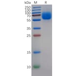 SDS-PAGE - Recombinant Human TYRO3 Protein (6×His Tag) (A318268) - Antibodies.com