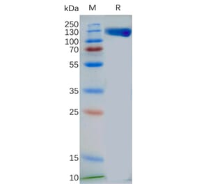 SDS-PAGE - Recombinant Human TLR3 Protein (Fc Tag) (A318269) - Antibodies.com