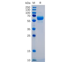 SDS-PAGE - Recombinant Human SIGLEC15 Protein (Fc Chimera 6xHis Tag) (A318270) - Antibodies.com