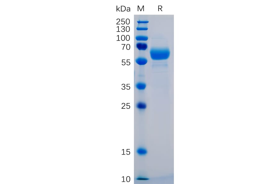 SDS-PAGE - Recombinant Human SIGLEC15 Protein (Fc Chimera 6xHis Tag) (A318270) - Antibodies.com