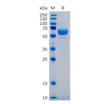 SDS-PAGE - Recombinant Human SIGLEC15 Protein (Fc Chimera 6xHis Tag) (A318270) - Antibodies.com
