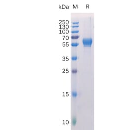 SDS-PAGE - Recombinant Human ROR1 Protein (6×His Tag) (A318271) - Antibodies.com